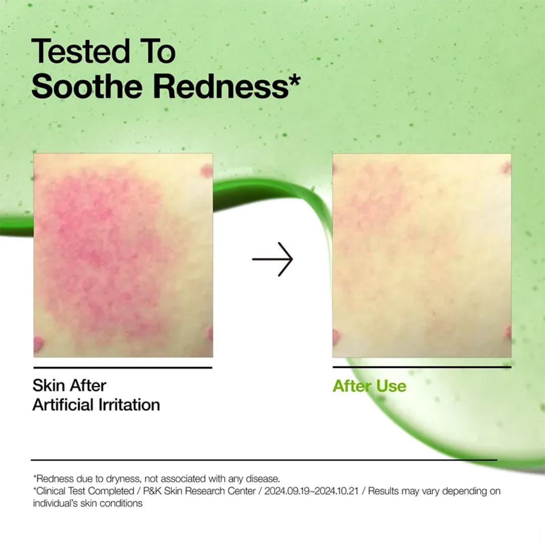Anua Azelaic Acid 10% + Hyaluronic Acid Redness Relief Soothing Serum, 30ml