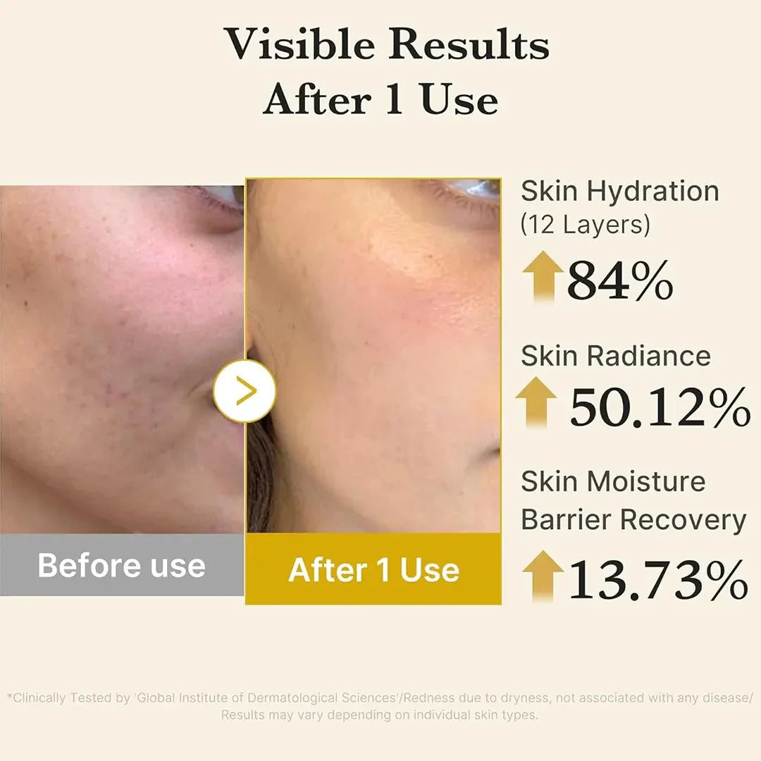 Medicube Kojic Acid and Turmeric Vita Jelly Mist Serum - 100ml Brightening Facial Spray