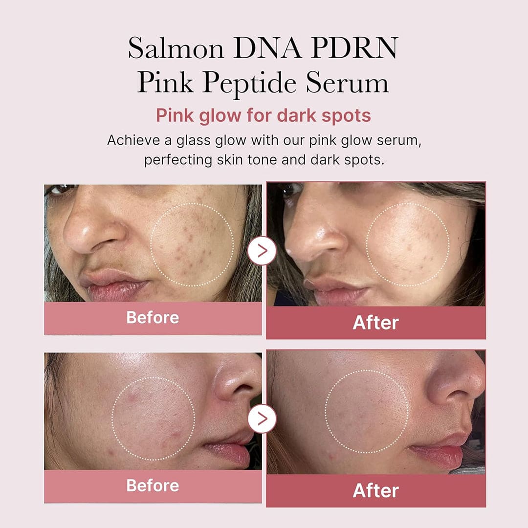 Medicube PDRN Pink Peptide Serum - 30ml - Anti-Aging and Skin Rejuvenation Treatment