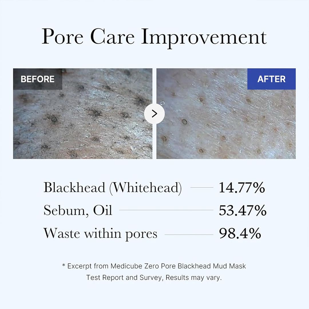 Medicube Zero Pore Blackhead MUD Mask - Deep Cleansing Pore Treatment 100g