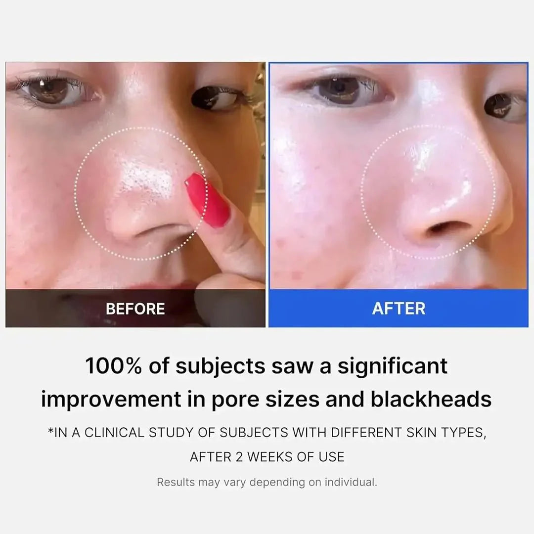 Medicube Zero Pore Pad Mild Exfoliating Toner Pads - 155g