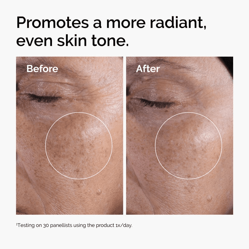 The Ordinary Glycolic Acid 7% Toning Solution - Exfoliating Facial Toner