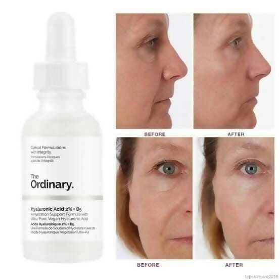 The Ordinary Hyaluronic Acid 2% + B5 Hydrating Serum - 30ml