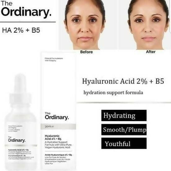 The Ordinary Hyaluronic Acid 2% + B5 Hydrating Serum - 30ml